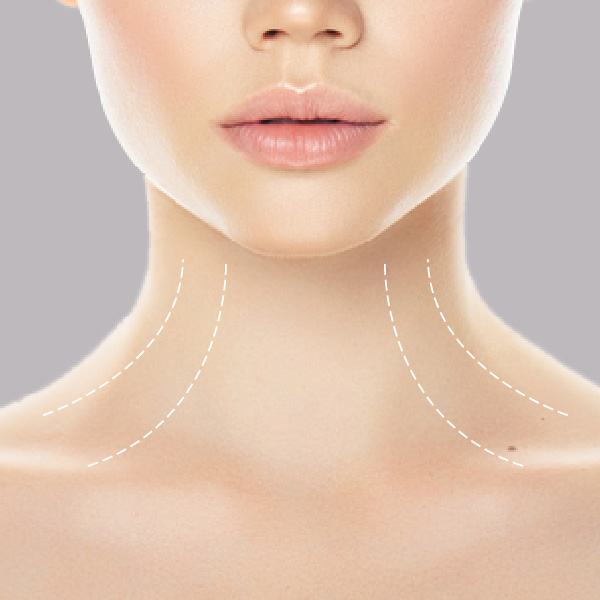 HIFU-neck-deccolatage-face-treatment-areas