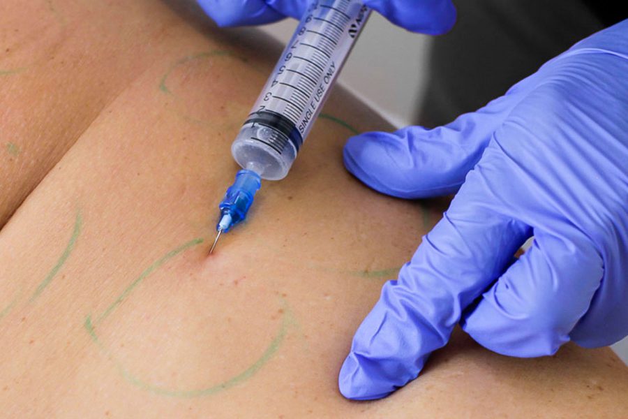 NonSurgical Butt Lift BBL Body Sculpting Clinics