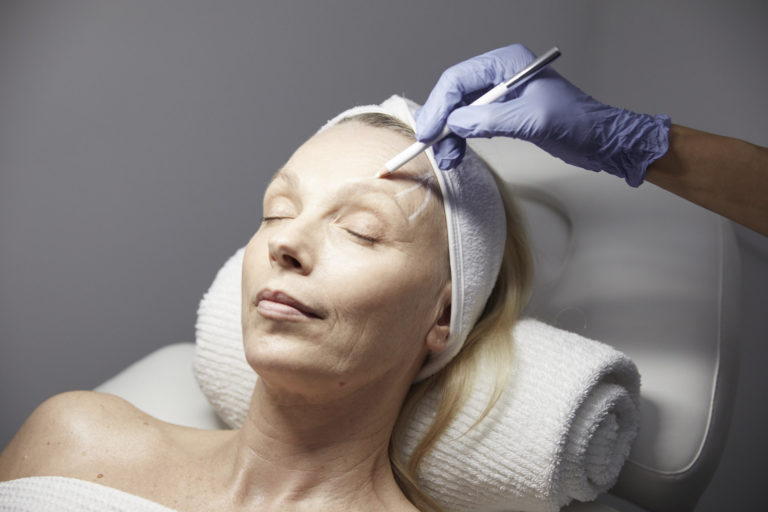 APTOS Thread Lift | Fix Saggy Skin | Body Sculpting Clinics