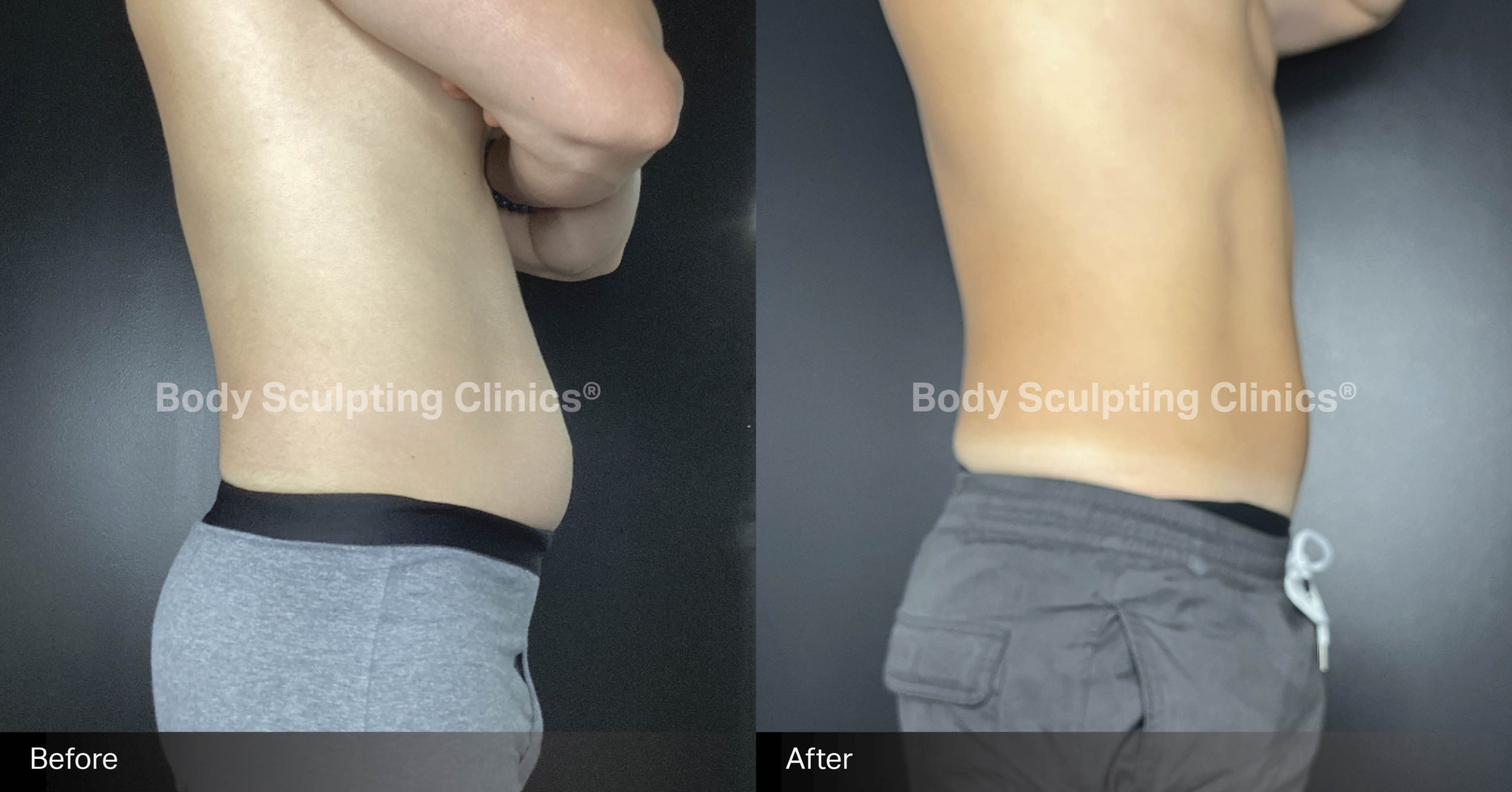 embody-abs-before-after-3