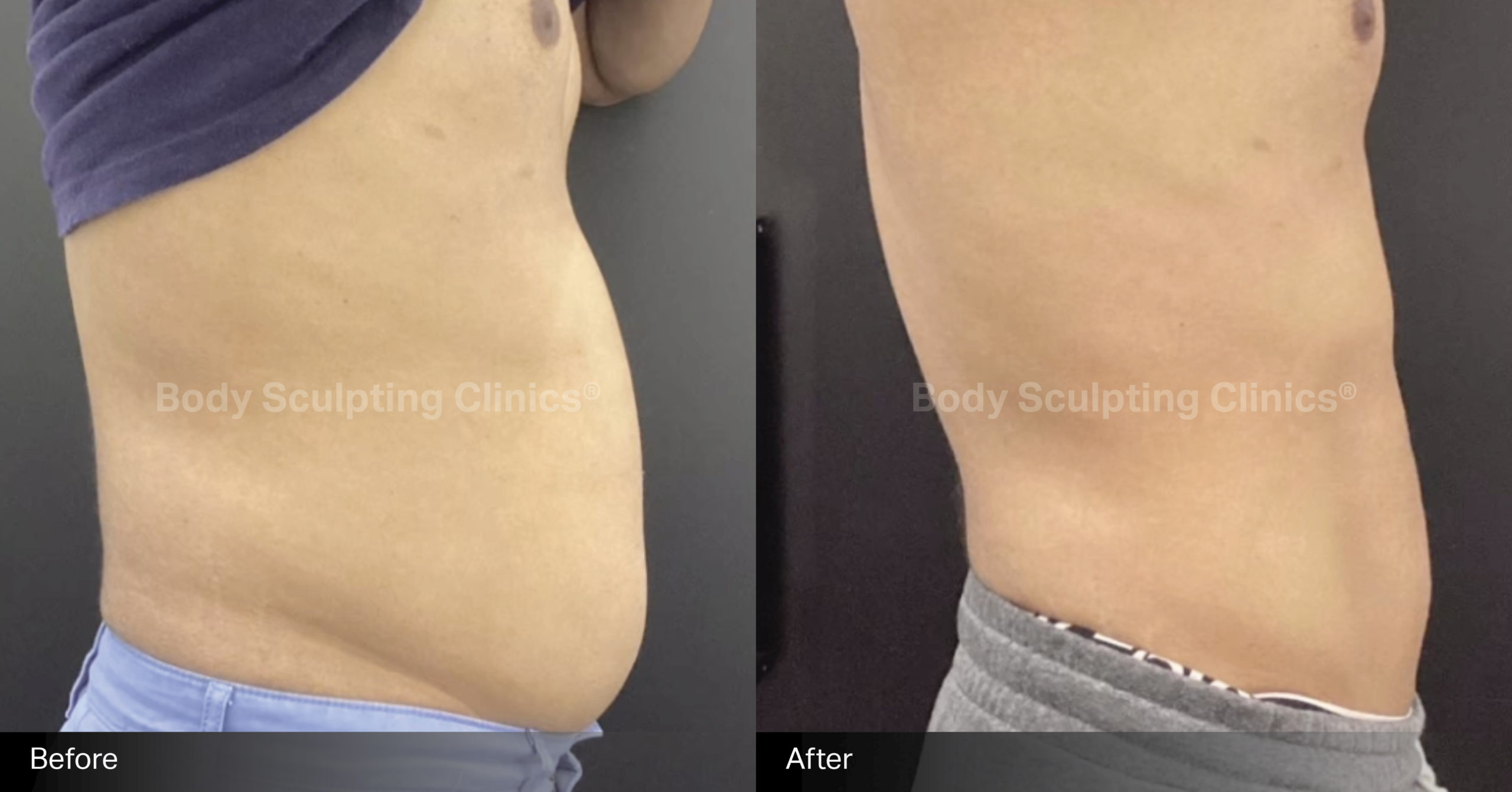 embody-abs-before-after-1