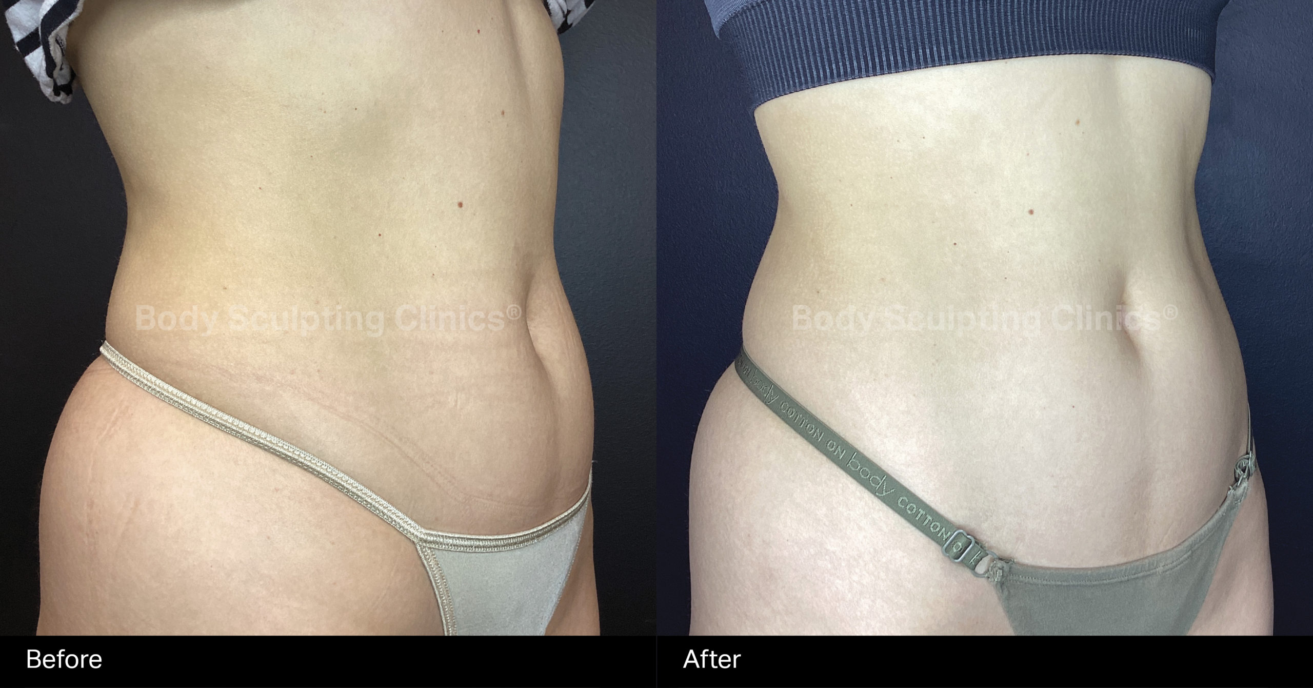 embody-8sessions-abs-female-B+A-1