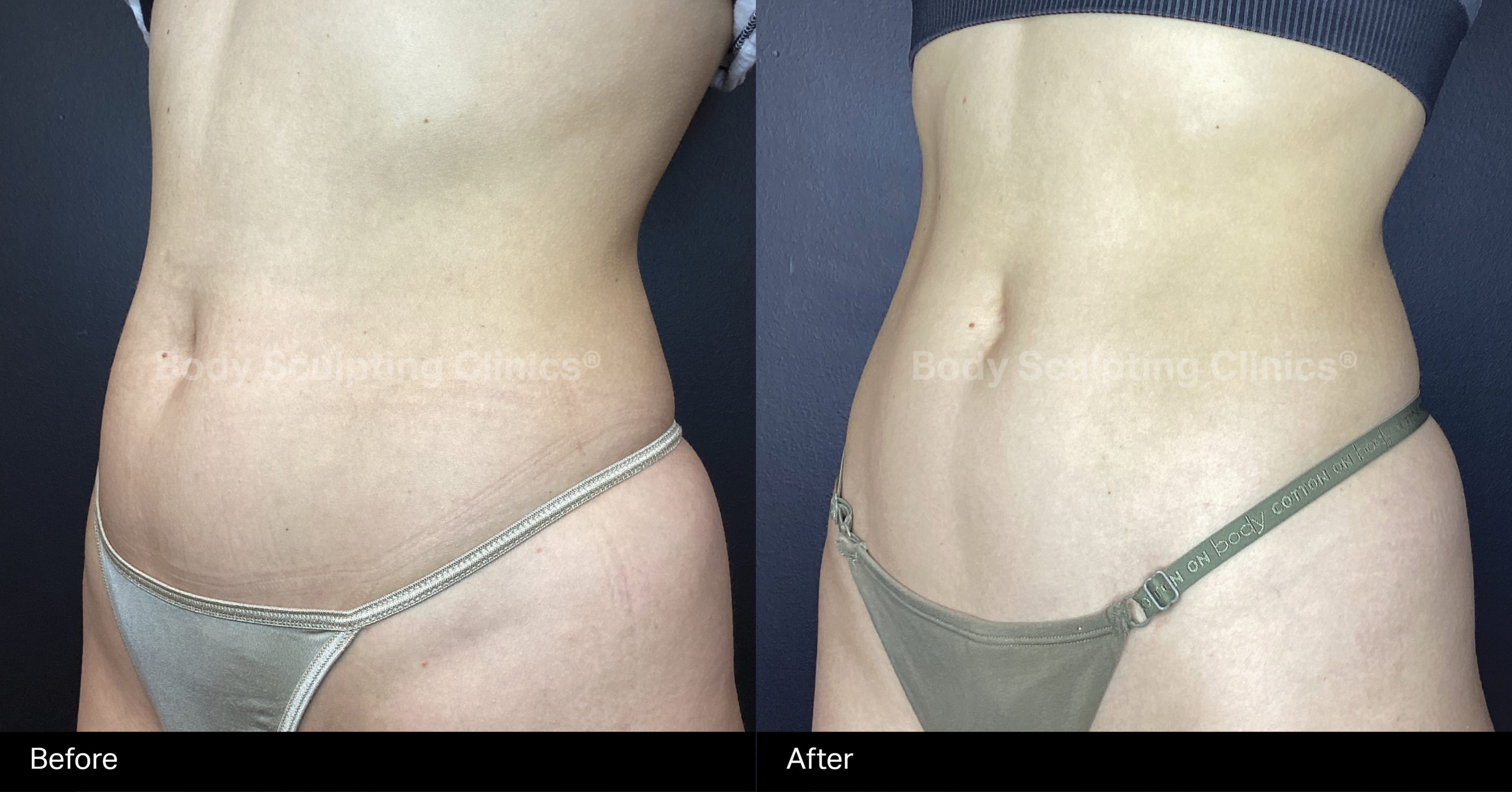 embody-8sessions-abs-female-B+A-2