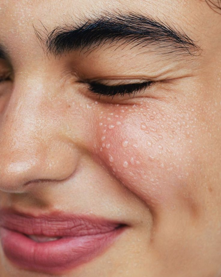 Woman with radiant skin enjoying summer outdoors, highlighting healthy glowing complexion