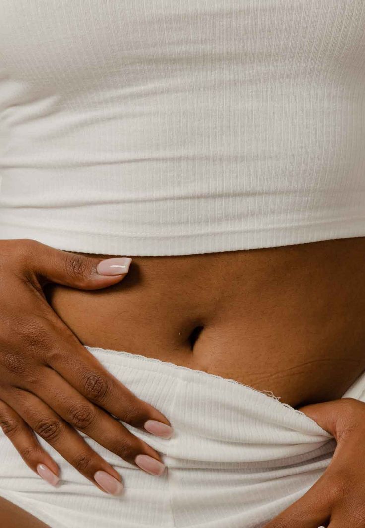 Abdomen showing loose or lax skin before non-surgical treatment.