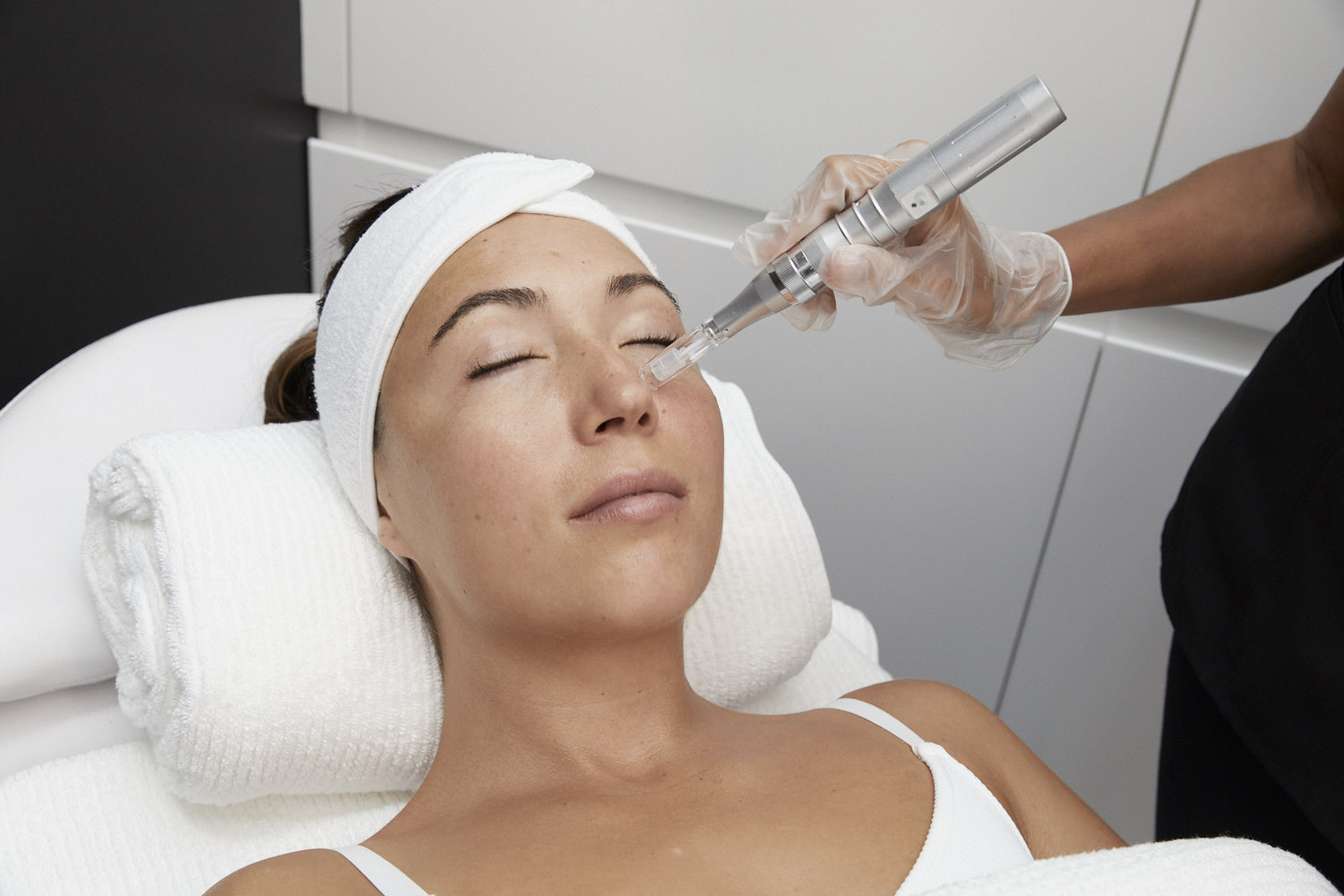 Microneedling Sydney