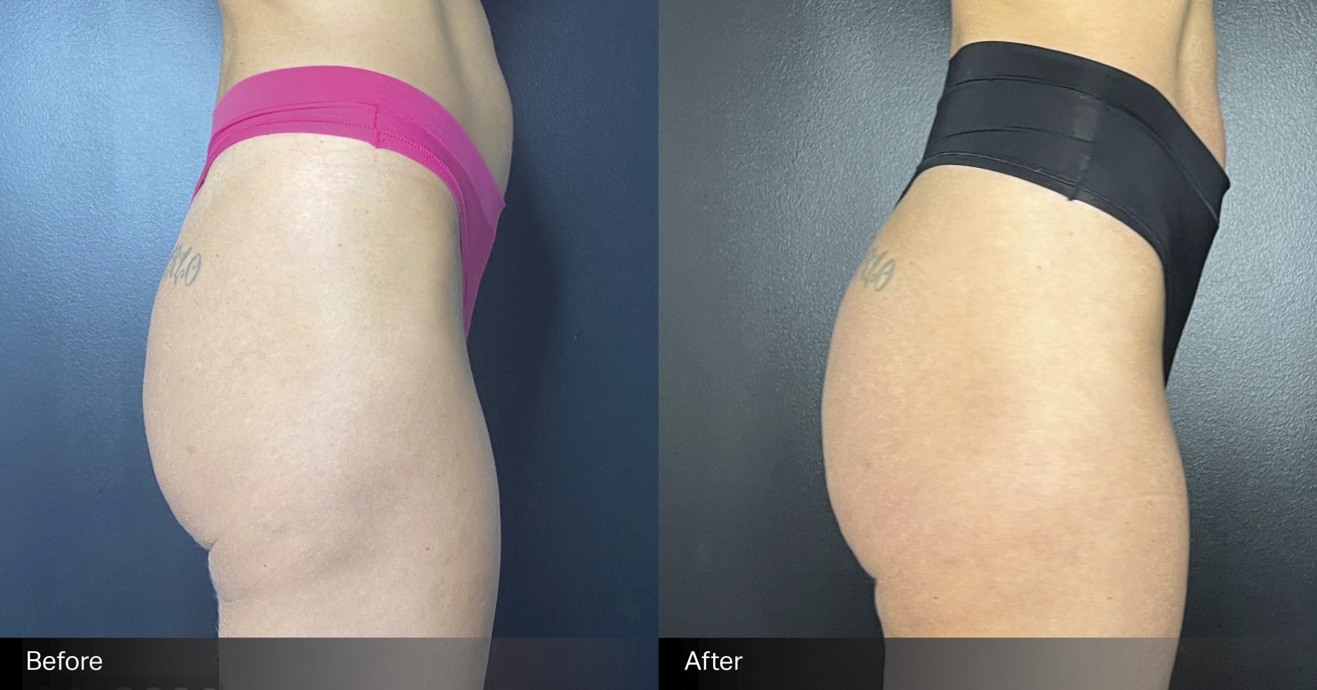 embody-glute-B+A-1