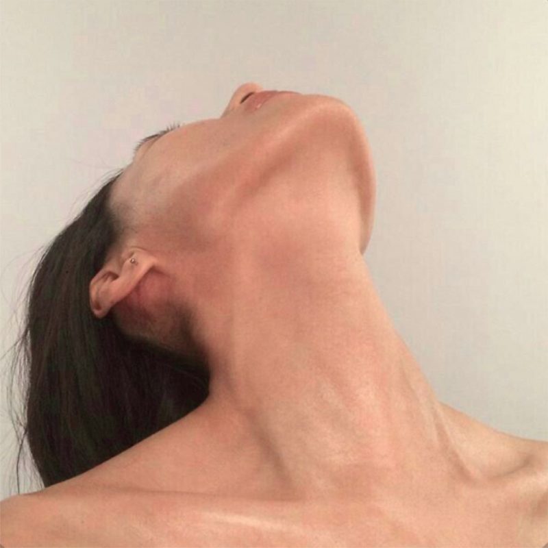 Woman tilting her head back to show a defined jawline and smooth neck profile, illustrating results of non-surgical double chin reduction treatment