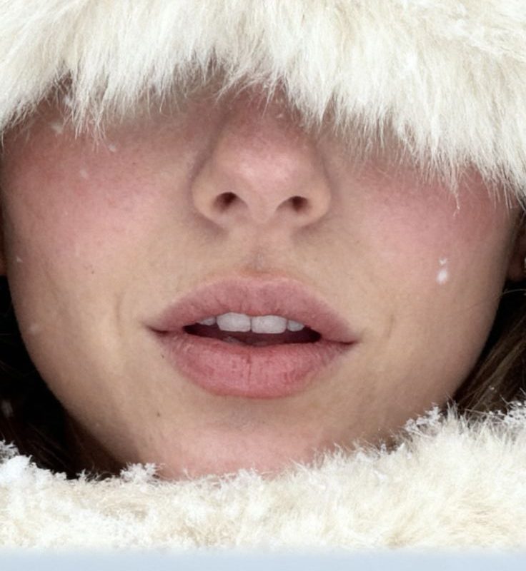 Close-up of a person's rosy winter complexion framed by white fur, highlighting skin renewal during cold, low-UV months.